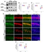 DNM1L Antibody in Western Blot (WB)