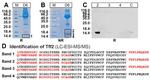 TFF2 Antibody in Western Blot (WB)