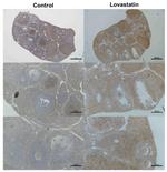 LDLR Antibody in Immunohistochemistry (Paraffin) (IHC (P))