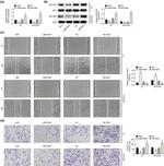 NECAB3 Antibody in Western Blot (WB)