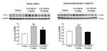 GLT-1 Antibody in Western Blot (WB)