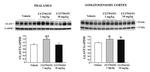 GLT-1 Antibody in Western Blot (WB)