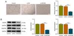 VEGF Antibody in Western Blot (WB)