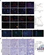 SIGLEC15 Antibody in Immunohistochemistry (Paraffin) (IHC (P))