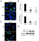 Phospho-Tau (Ser422) Antibody in Immunocytochemistry (ICC/IF)