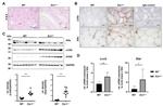 Estrogen Receptor alpha Antibody in Immunohistochemistry (Paraffin) (IHC (P))