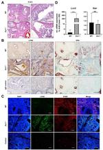 Estrogen Receptor alpha Antibody in Immunohistochemistry (Paraffin) (IHC (P))