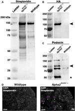 Podocin Antibody in Western Blot (WB)