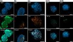 HIF1A Antibody in Immunohistochemistry (Paraffin) (IHC (P))