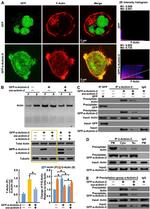 alpha Actinin 2 Antibody in Western Blot, Immunoprecipitation (WB, IP)