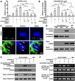 alpha Actinin 2 Antibody in Western Blot, Immunoprecipitation (WB, IP)