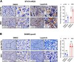 IRS1 Antibody in Immunohistochemistry (Paraffin) (IHC (P))