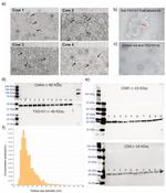 TSG101 Antibody in Western Blot (WB)