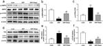 LC3A/LC3B Antibody in Western Blot (WB)