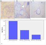 TGF beta-1 Antibody in Immunohistochemistry (Paraffin) (IHC (P))