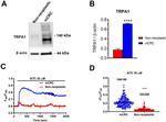 TRPA1 Antibody in Western Blot (WB)