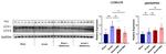 LC3A/LC3B Antibody in Western Blot (WB)