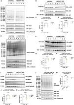 O-linked N-acetylglucosamine (O-GlcNAc) Antibody in Western Blot (WB)