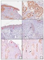 HMOX1 Antibody in Immunohistochemistry (Paraffin) (IHC (P))