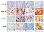 VEGF Antibody in Immunohistochemistry (Paraffin) (IHC (P))