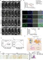 CD61 (Integrin beta 3) Antibody in Immunohistochemistry (Paraffin) (IHC (P))