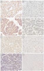 SNAIL Antibody in Immunohistochemistry (Paraffin) (IHC (P))