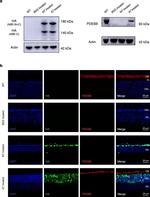 PDE6B Antibody in Western Blot (WB)