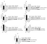 Tyrosine Hydroxylase Antibody in Western Blot (WB)