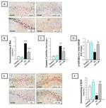 Bax Antibody in Immunohistochemistry (Paraffin) (IHC (P))