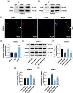 Apolipoprotein B Antibody in Immunoprecipitation (IP)