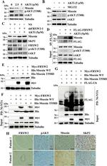 Moesin Antibody in Immunohistochemistry (Paraffin) (IHC (P))