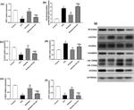 LC3B Antibody in Western Blot (WB)