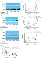 SNW1 Antibody in Immunoprecipitation, ChIP Assay (IP, ChIP)