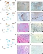 PRRX1 Antibody in Immunohistochemistry (Paraffin) (IHC (P))