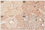 VDR Antibody in Immunohistochemistry (Paraffin) (IHC (P))