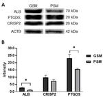 CRISP2 Antibody in Western Blot (WB)