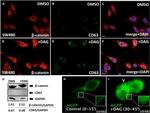 beta Catenin Antibody in Western Blot (WB)