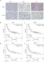 Kallikrein 7 Antibody in Immunohistochemistry (Paraffin) (IHC (P))