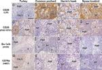 CD20 Antibody in Immunohistochemistry (Paraffin) (IHC (P))