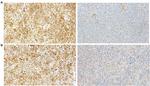 GluR2 Antibody in Immunohistochemistry (IHC)