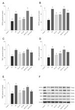 SIRT1 Antibody in Western Blot (WB)