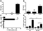 TNF alpha Antibody in Neutralization (Neu)