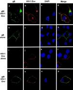 Herpes Simplex Virus Type 1/2 gB Antibody in Immunocytochemistry (ICC/IF)