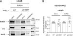 SUR2A Antibody in Western Blot (WB)