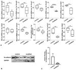 N-cadherin Antibody in Western Blot (WB)