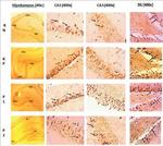 p16INK4a Antibody in Immunohistochemistry (Paraffin) (IHC (P))