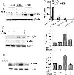 CD61 (Integrin beta 3) Antibody in Western Blot (WB)