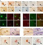 Phospho-Tau (Thr231) Antibody in Immunohistochemistry (Paraffin) (IHC (P))