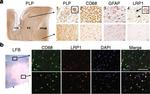 CD68 Antibody in Immunohistochemistry (IHC)