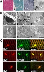 Calsequestrin Antibody in Immunohistochemistry (IHC)